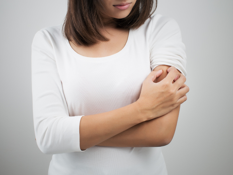 5 obat alami alergi gatal pada kulit ampuh meredakan gejala