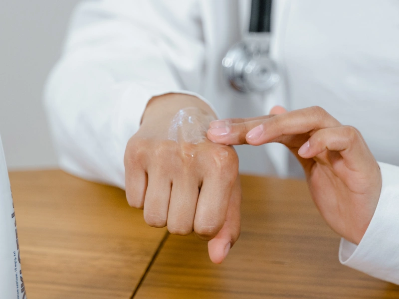 rekomendasi handbody untuk kulit eksim terbaik dan aman digunakan