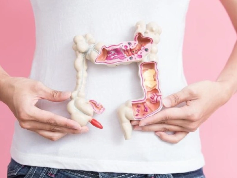 Colonoscopy Prosedur