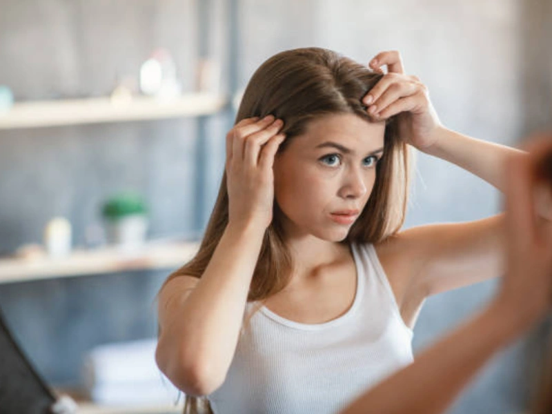 ketombe dan psoriasis